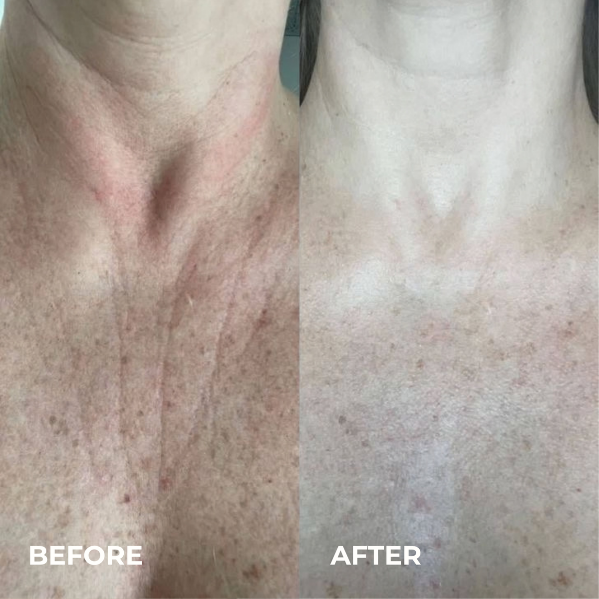 Silk Peptide EGF Tox Toner