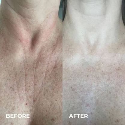Silk Peptide EGF Tox Toner