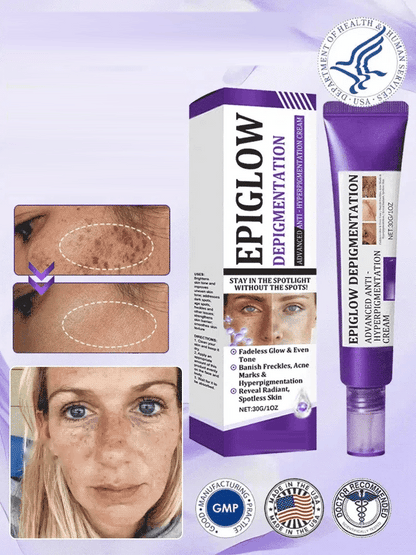 BUY 1 GET 1 FREE - Brightening & Even Tone Cream
