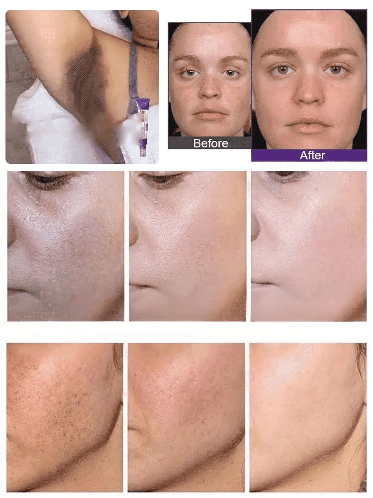 BUY 1 GET 1 FREE - Brightening & Even Tone Cream