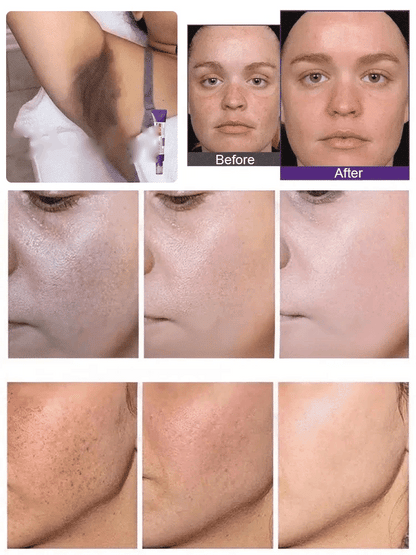 BUY 1 GET 1 FREE - Brightening & Even Tone Cream