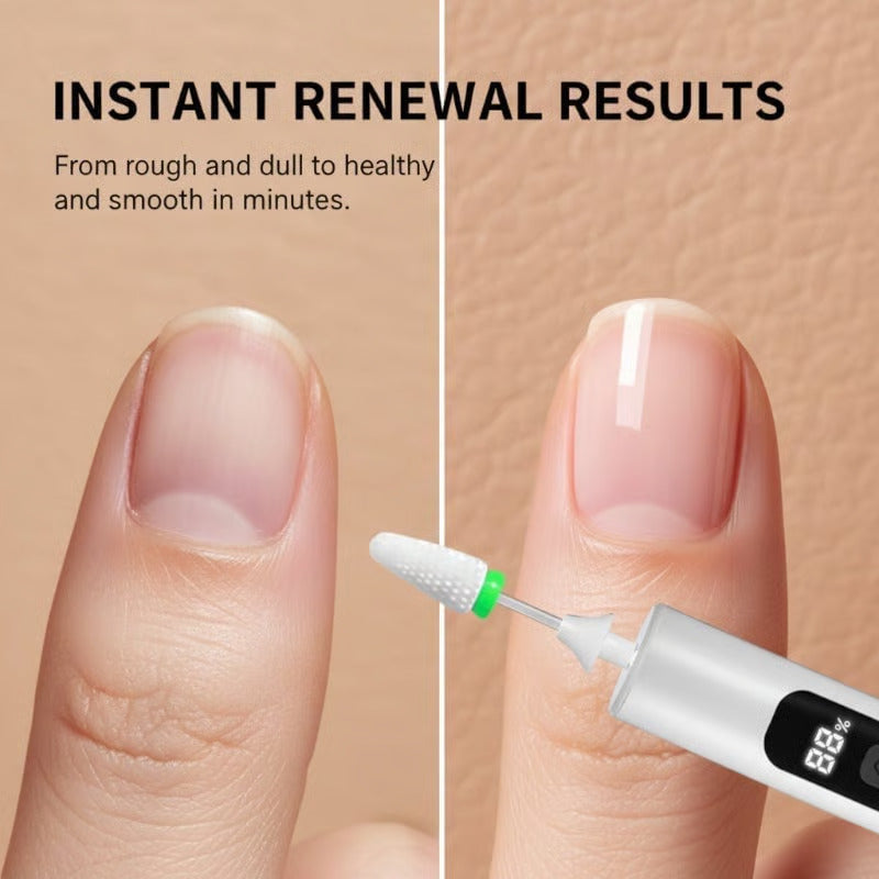 Instant nail renewal results