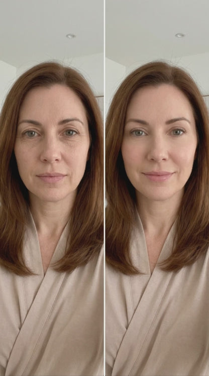 Reverse-Aging Eye Tightener
